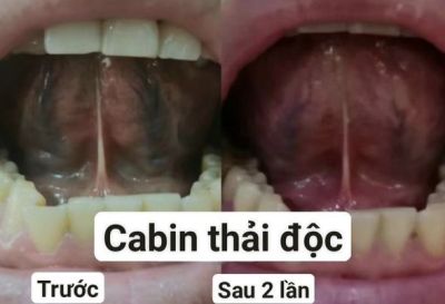 9 cách thải độc cơ thể cho ngày mới năng động