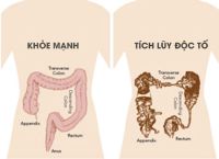 Độc tố trong cơ thể con người