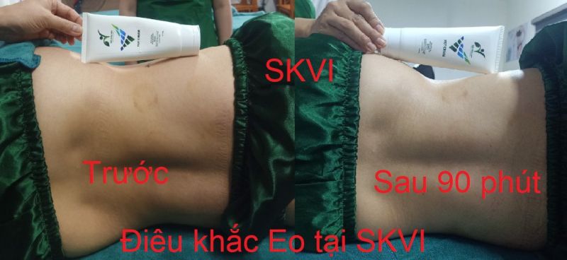 Điêu khắc eo skvi