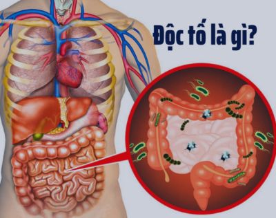 Độc tố là gì?